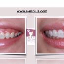 미플러스 이미지