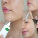 (주)웰코스 | 피부트러블개선 도와준 다이소 크림, 아크네스 화이트티트리 스팟크림 진정 될까?
