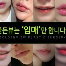 골든뷰 이미지