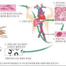 말라리아 및 원인과 검사 백신 (약) 모기 지역 전염 이미지