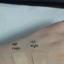 디케이스킨 이미지