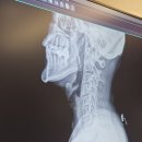 하하정형외과의원 | 부평 정형외과 도수치료 왕추천! 버섯목과 회전근 내돈내산 후기