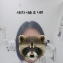 유지도트 | 수원 두피커버 뷰테르 두피문신 내돈내산 2탄｜반년 후 색변화? 도트 번짐? 솔직 유지 후기