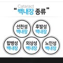 맑은눈안과 이미지