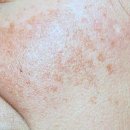 마인드닥터의원 | 나이 들수록 고민되는 주름개선, 생기 넘치는 피부로 돌아가는 법