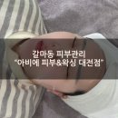 한마음어린이공원 화장실 | [갈마동 피부관리] "아비에 피부&amp;왁싱 대전점"에서 여름듬압출과 여드름진정관리 후기