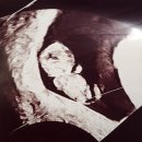 한마음병원 건너편 횡단보도 | 대구 미라클 박동수 원장님 첫진료 후기(초진예약 기다리다 자연임신 9주1일)