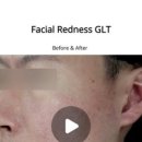 청담글래시피부과의원 이미지