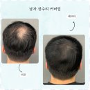 김천SMP 자연스러움을 되찾는 SMP 디블랙아카데미 후기