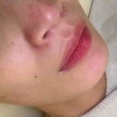 더맑은스킨 광주신창점 네이버블로그