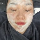 안산고잔동피부관리 탁월한 선택 메리미뷰티 이중턱관리 후기