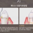 제니스치과의원 이미지