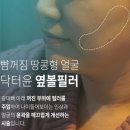 옆볼필러 후기 인상 변화까지 체감한 솔직 리뷰