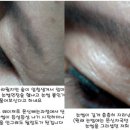 래쉬올린
