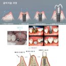 서울이음치과 네이버블로그