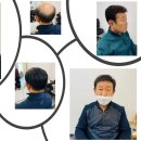 재구가발 네이버블로그