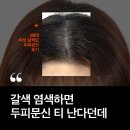정수리 | 여성 두피문신 염색 머리 부작용에 대한 20대 정수리 후기