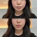 웰247 페이스튠핏 후기 에스테틱 관리 이젠 집에서 해결