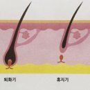 벨로왁싱 이미지