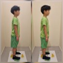 체형교정 태권도 | [리뷰] 수원골반교정부터 일자목교정까지! 국가대표체형교정센터 다녀온 리얼 후기