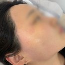 양정왁싱 저자극저통증 페이스왁싱 잘하는 곳 은하뷰티 방문후기