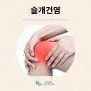 스포츠의학센터 티스토리