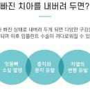 올스마일치과의원 네이버블로그