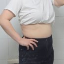 예쁜라인 | 인천 다이어트 복부 팔뚝 라인관리 솔직후기, 예쁜 바디라인 만들기 전문병원에서 시작한 변화