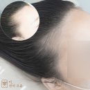 미선이고운 | 대구 중구 대명동 남산동 헤어라인 추천 미선이고운 후기