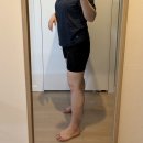 다이어트병원 허벅지지방분해주사 5주 체지방 감량 솔직후기