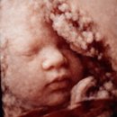 마리나유치원 | [이천]마리나산부인과 입체초음파후기 /입체초음파/ai가만들어준아기얼굴