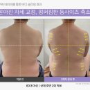 [공지] 성남 바디관리 &#39;통증잡고 지방 잡는 더마웨이브 테라피&#39; 후기(1)