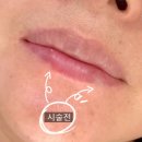 인생비어 | 어둡거나 비어있는 입술도 마르큐큐에서 인생입술로 재탄생! 실제후기!!