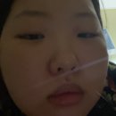 좀비어게인