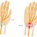 옐로우 터널 이미지