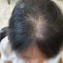 더룩 헤어