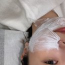 안양범계피부과 볼뉴머와 슈링크유니버스를 합친 볼링크 받고온후기