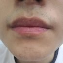 에이치봄의원 이미지