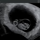 연세맘스그린여성의원 이미지