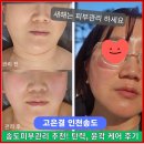 아진프라자 복합상가(1층) | 송도피부관리 추천 고은결 인천송도에서 탄력 윤곽 케어 받고 어려보이는 피부로!