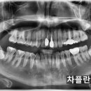 차플란트치과의원 이미지