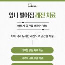 중동네이버치과 | 창원중동치과 앞니 벌어졌나요? 꼭 확인해 주세요