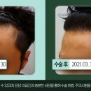 청담모바로의원 이미지