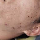 갈티로 | 환절기 40대 남자피부관리는...:) 광양읍 라라피부관리- 쳇...나만하려했는데...