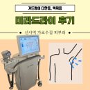 미라드라이 가격 후기 겨드랑이 땀 억제 시술 실비 부작용
