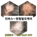 탈모응급실 리버스-다시태어나다 이미지