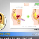 [대구비뇨기과/대구조루증/대구코넬비뇨기과]비뇨기과 의사가 밝히는 조루증 완전치료 전략 (38)-끈기”있는 노력이 조루증에서 벗어나는 최고요소 이미지