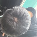 저 지금 이거 탈모일까요? 도와주세요.. 이미지