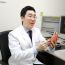 위암 수술 후 재발, 조심해야할 시기&amp;위암 재발 예방법 이미지