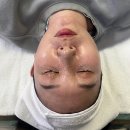 수원-1217 | 수원피부관리ㅣ4세대 스킨플래닝 ‘엑시드닝’으로 안색이 환해진 후기